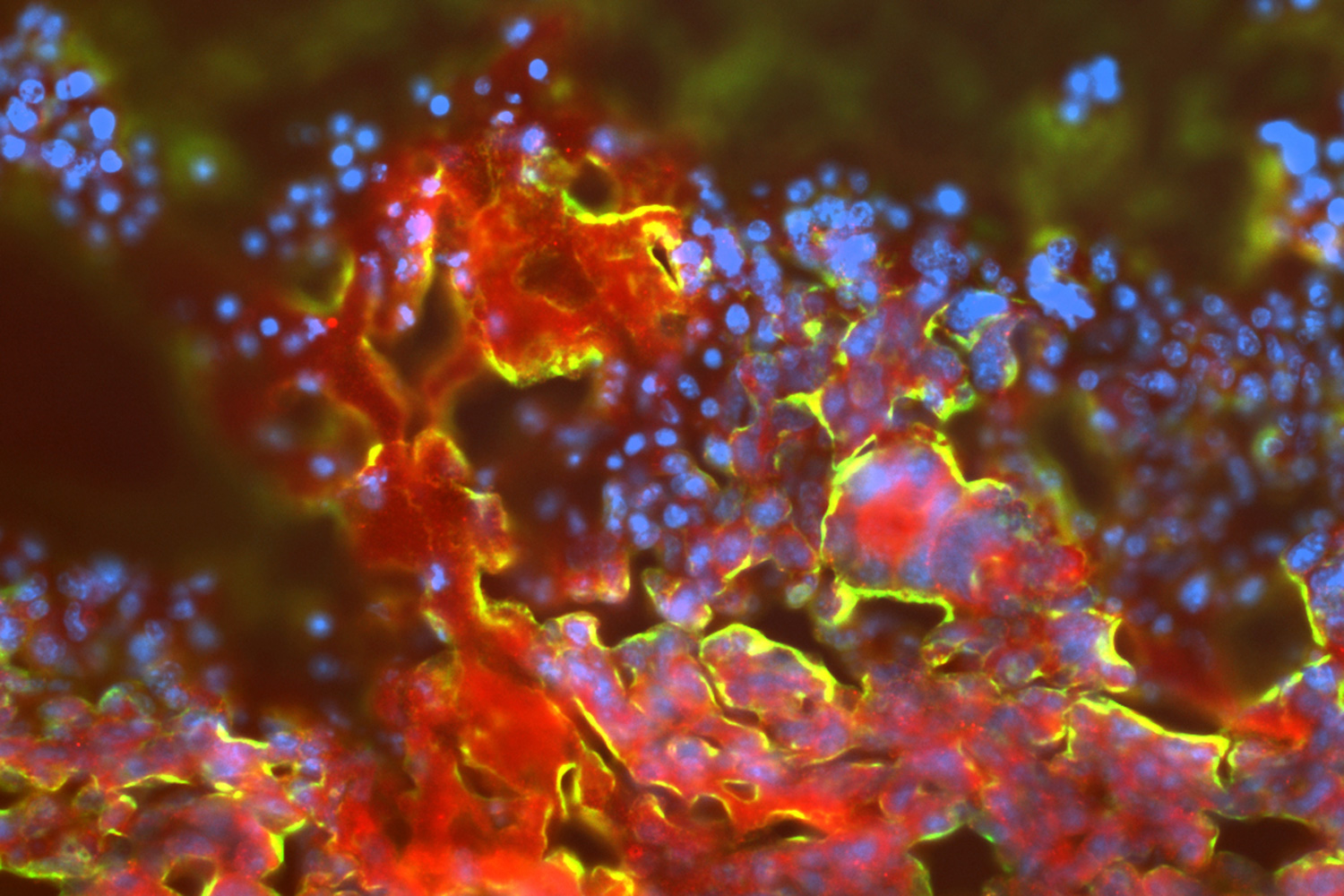 Aufnahme von gelb, blau, rot und grün fluoreszierenden Zellen.