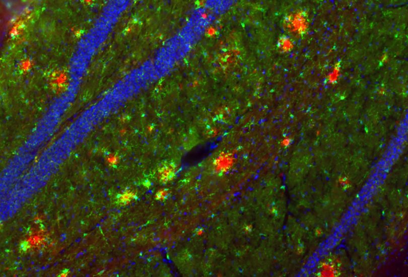 Die Abbildung zeigt eine mikroskopische Aufnahme des Maus-Hippocampus. In roter Farbe sind die A-beta-Ablagerungen sichtbar gemacht worden. Um diese Alzheimer-typischen Ablagerungen in der Maus untersuchen zu können, sind spezielle Mausmodelle notwendig, die auch von der AG Korte im Rahmen dieser Studie verwendet wurden. Bildnachweis: Holz, Korte/TU Braunschweig