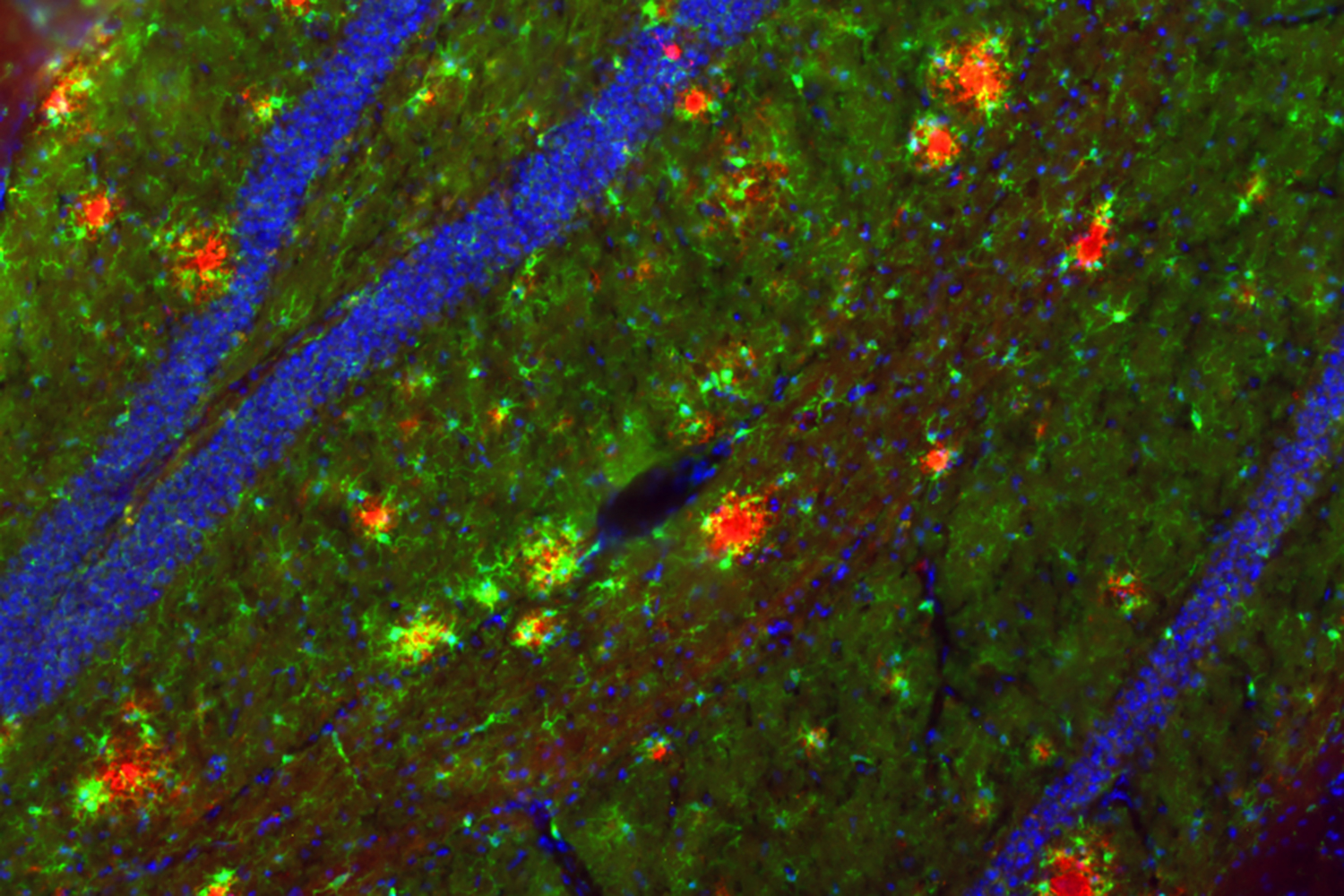 Die Abbildung zeigt eine mikroskopische Aufnahme des Maus-Hippocampus. In roter Farbe sind die A-beta-Ablagerungen sichtbar gemacht worden. Um diese Alzheimer-typischen Ablagerungen in der Maus untersuchen zu können, sind spezielle Mausmodelle notwendig, die auch von der AG Korte im Rahmen dieser Studie verwendet wurden. Bildnachweis: Holz, Korte/TU Braunschweig